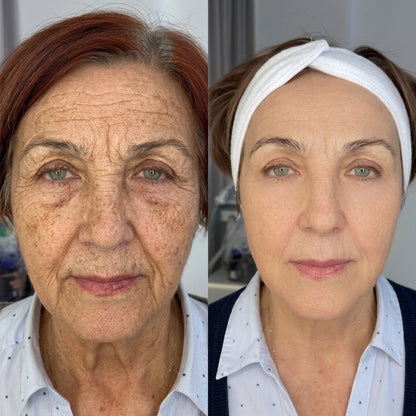 𝐇𝐢𝐬𝐤𝐢𝐧 ® 👨‍⚕️👨‍⚕️𝑷𝑫𝑹𝑵 𝑨𝒏𝒕𝒊-𝑨𝒈𝒊𝒏𝒈 & 𝑻𝒂𝒓𝒈𝒆𝒕𝒆𝒅 𝑺𝒑𝒐𝒕 𝑹𝒆𝒏𝒆𝒘𝒂𝒍 𝑺𝒕𝒊𝒄𝒌（𝑯𝒆𝒍𝒑𝒔 𝑺𝒎𝒐𝒐𝒕𝒉 𝑾𝒓𝒊𝒏𝒌𝒍𝒆𝒔, 𝑺𝒖𝒑𝒑𝒐𝒓𝒕 𝑭𝒊𝒓𝒎𝒆𝒓-𝑳𝒐𝒐𝒌𝒊𝒏𝒈 𝑺𝒌𝒊𝒏, 𝒂𝒏𝒅 𝑰𝒎𝒑𝒓𝒐𝒗𝒆 𝑻𝒉𝒆 𝑨𝒑𝒑𝒆𝒂𝒓𝒂𝒏𝒄𝒆 𝑶𝒇 𝑽𝒊𝒔𝒊𝒃𝒍𝒆 𝑺𝒑𝒐𝒕𝒔）