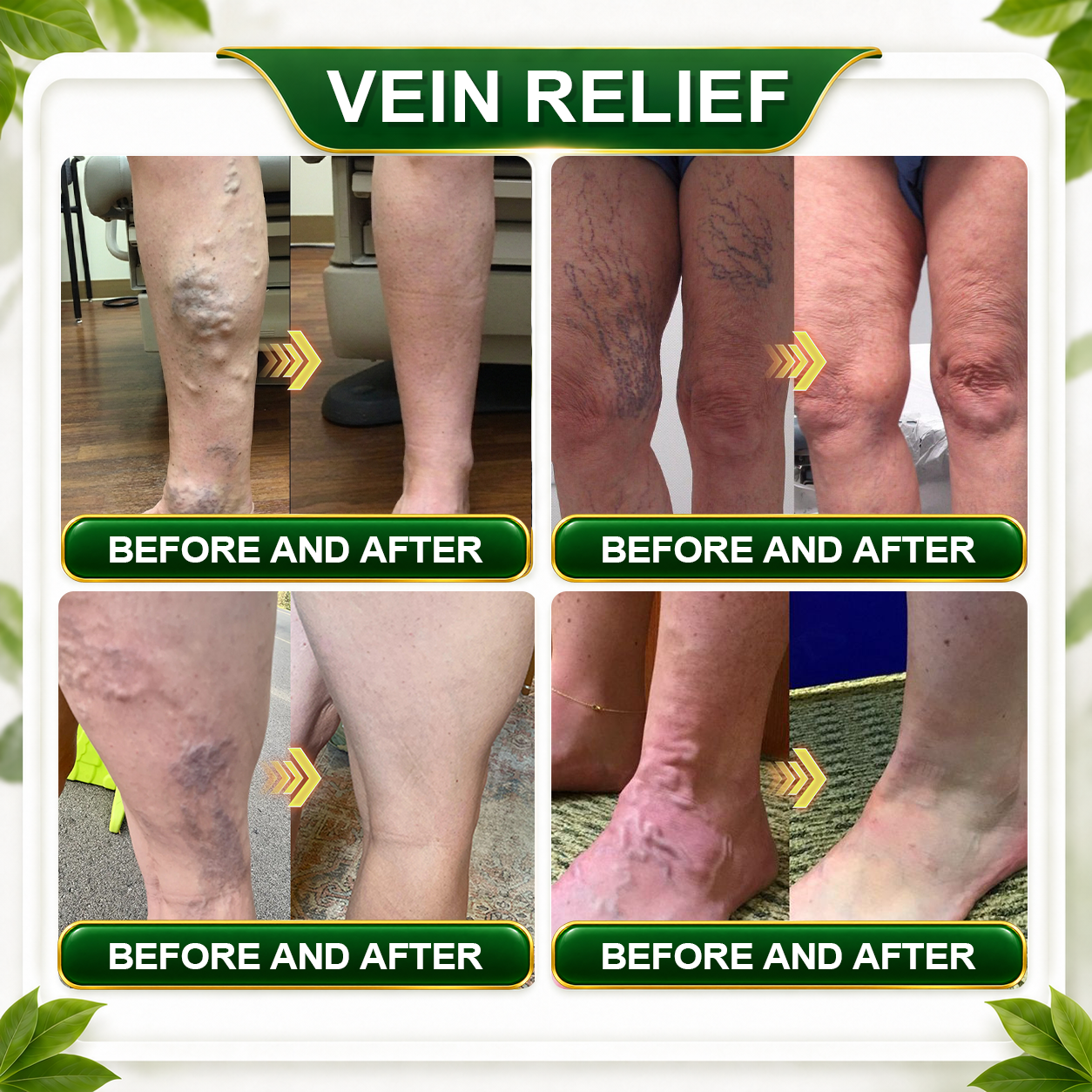 ☘️𝑮𝒓𝒆𝒆𝒏𝑭𝒆𝒆𝒍® 𝑩𝒆𝒓𝒃𝒆𝒓𝒊𝒏𝒆 𝑴𝒐𝒓𝒊𝒏𝒈𝒂- 𝑩𝒆𝒆 𝑽𝒆𝒏𝒐𝒎 𝑫𝒆𝒕𝒐𝒙 𝑺𝒍𝒊𝒎𝒎𝒊𝒏𝒈 𝑭𝒐𝒐𝒕 𝑺𝒐𝒂𝒌 𝑩𝒆𝒂𝒅 𝑺𝒖𝒑𝒑𝒐𝒓𝒕𝒔 𝑾𝒆𝒊𝒈𝒉𝒕 𝑴𝒂𝒏𝒂𝒈𝒆𝒎𝒆𝒏𝒕, 𝑳𝒚𝒎𝒑𝒉𝒂𝒕𝒊𝒄 𝑫𝒓𝒂𝒊𝒏𝒂𝒈𝒆, 𝑯𝒆𝒂𝒍𝒕𝒉𝒚 𝑪𝒊𝒓𝒄𝒖𝒍𝒂𝒕𝒊𝒐𝒏, 𝑭𝒆𝒎𝒊𝒏𝒊𝒏𝒆 𝑾𝒆𝒍𝒍𝒏𝒆𝒔𝒔 & 𝑭𝒊𝒓𝒎𝒆𝒓-𝑳𝒐𝒐𝒌𝒊𝒏𝒈 𝑺𝒌𝒊𝒏🔥