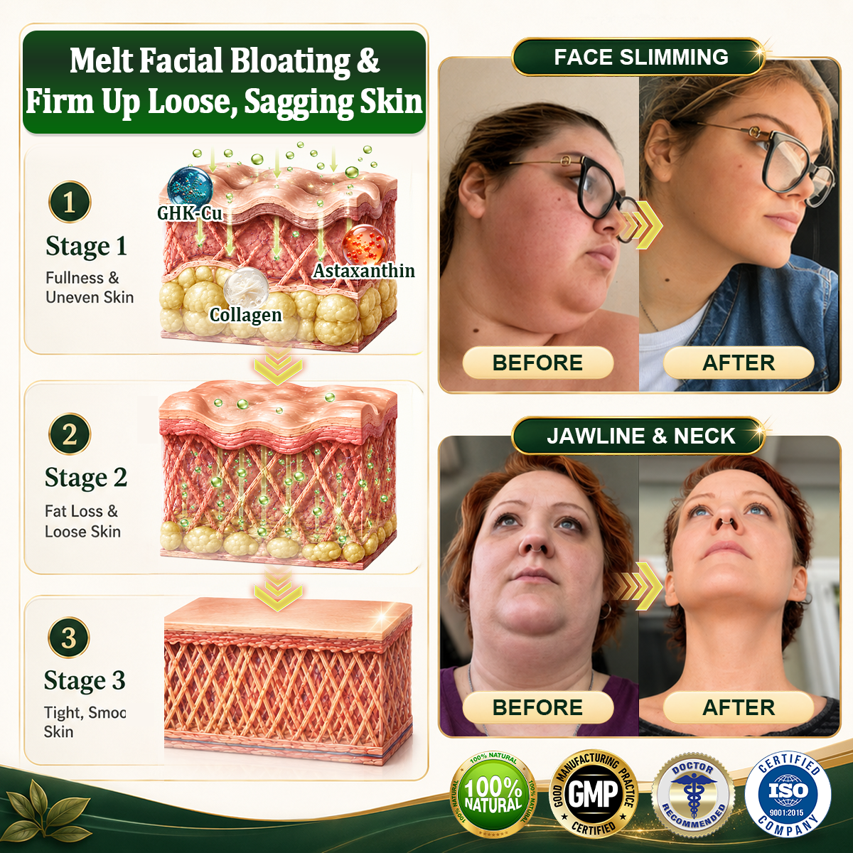 ☘️𝑮𝒓𝒆𝒆𝒏𝑭𝒆𝒆𝒍® 𝑩𝒆𝒓𝒃𝒆𝒓𝒊𝒏𝒆 𝑴𝒐𝒓𝒊𝒏𝒈𝒂- 𝑩𝒆𝒆 𝑽𝒆𝒏𝒐𝒎 𝑫𝒆𝒕𝒐𝒙 𝑺𝒍𝒊𝒎𝒎𝒊𝒏𝒈 𝑭𝒐𝒐𝒕 𝑺𝒐𝒂𝒌 𝑩𝒆𝒂𝒅 𝑺𝒖𝒑𝒑𝒐𝒓𝒕𝒔 𝑾𝒆𝒊𝒈𝒉𝒕 𝑴𝒂𝒏𝒂𝒈𝒆𝒎𝒆𝒏𝒕, 𝑳𝒚𝒎𝒑𝒉𝒂𝒕𝒊𝒄 𝑫𝒓𝒂𝒊𝒏𝒂𝒈𝒆, 𝑯𝒆𝒂𝒍𝒕𝒉𝒚 𝑪𝒊𝒓𝒄𝒖𝒍𝒂𝒕𝒊𝒐𝒏, 𝑭𝒆𝒎𝒊𝒏𝒊𝒏𝒆 𝑾𝒆𝒍𝒍𝒏𝒆𝒔𝒔 & 𝑭𝒊𝒓𝒎𝒆𝒓-𝑳𝒐𝒐𝒌𝒊𝒏𝒈 𝑺𝒌𝒊𝒏🔥