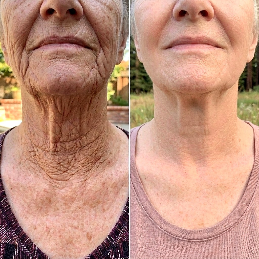 𝐇𝐢𝐬𝐤𝐢𝐧 ® 👨‍⚕️👨‍⚕️𝑷𝑫𝑹𝑵 𝑨𝒏𝒕𝒊-𝑨𝒈𝒊𝒏𝒈 & 𝑻𝒂𝒓𝒈𝒆𝒕𝒆𝒅 𝑺𝒑𝒐𝒕 𝑹𝒆𝒏𝒆𝒘𝒂𝒍 𝑺𝒕𝒊𝒄𝒌（𝑯𝒆𝒍𝒑𝒔 𝑺𝒎𝒐𝒐𝒕𝒉 𝑾𝒓𝒊𝒏𝒌𝒍𝒆𝒔, 𝑺𝒖𝒑𝒑𝒐𝒓𝒕 𝑭𝒊𝒓𝒎𝒆𝒓-𝑳𝒐𝒐𝒌𝒊𝒏𝒈 𝑺𝒌𝒊𝒏, 𝒂𝒏𝒅 𝑰𝒎𝒑𝒓𝒐𝒗𝒆 𝑻𝒉𝒆 𝑨𝒑𝒑𝒆𝒂𝒓𝒂𝒏𝒄𝒆 𝑶𝒇 𝑽𝒊𝒔𝒊𝒃𝒍𝒆 𝑺𝒑𝒐𝒕𝒔）